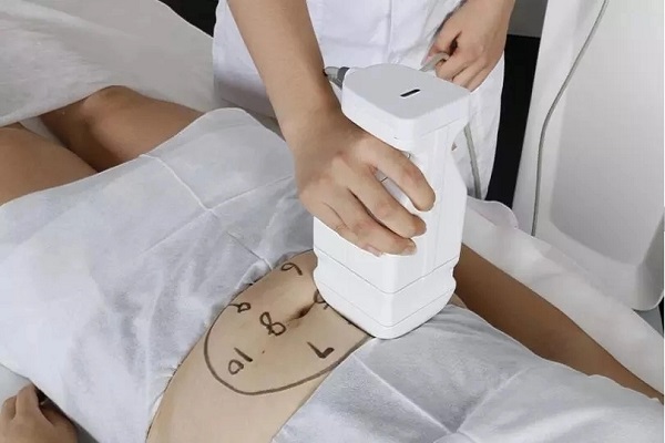 SW-141B Hifu ultrasound Vmax face lift anti-aging lipohifu weight loss fat removal machine